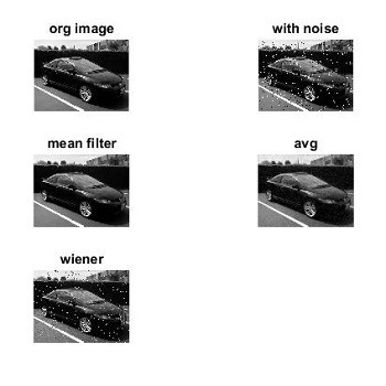 شبیه سازی حذف نویز تصویر به کمک فیلترهای مختلف با متلب