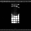 شبیه سازی کاهش نویز لکه ای تصاویر سونوگرافی با متلب