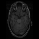 شبیه سازی قطعه بندی تصاویر MRI مغز با متلب