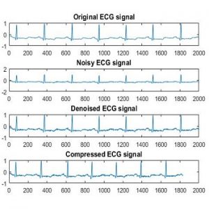 شبیه سازی فشرده سازی و حذف نویز سیگنال ECG با متلب