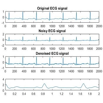 شبیه سازی و تولید سیگنال ECG با متلب