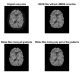 شبیه سازی کاهش نویز تصاویر MRI به کمک فیلتر وینر با متلب