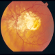 شبیه سازی ثبت تصویر شبکیه چشم بر اساس ویژگی با متلب