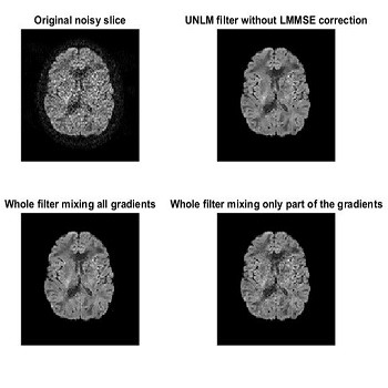 شبیه سازی کاهش نویز تصاویر MRI به کمک فیلتر وینر با متلب