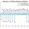 استخراج ویژگی سیگنال ECG قلب در متلب